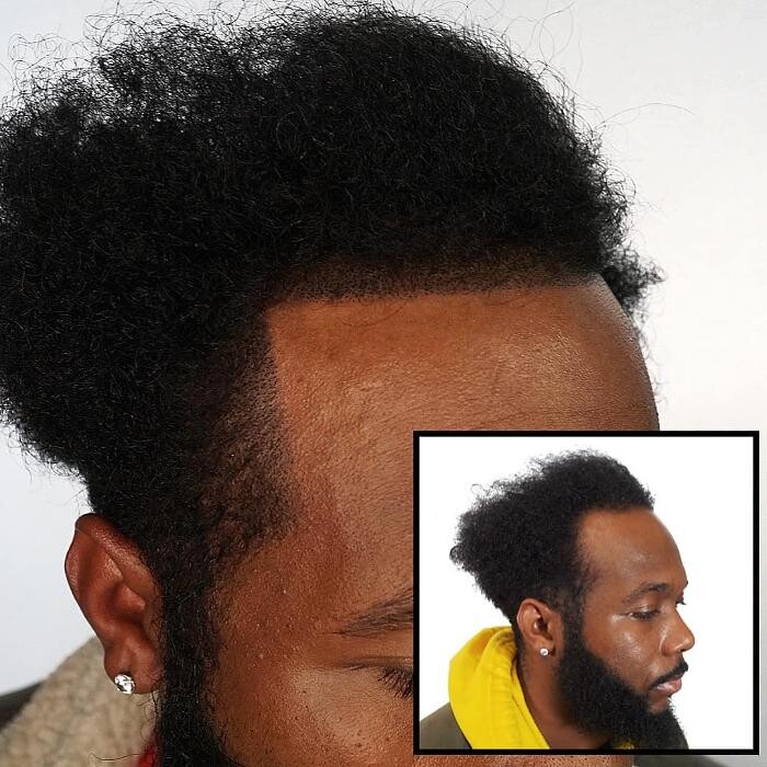 Images Picasso Scalp Micropigmentation - California