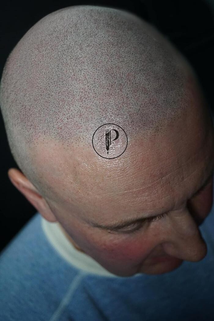 Images Picasso Scalp Micropigmentation - California