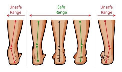 Images Lakeland Foot and Ankle - Dr. William S Wong, DPM, FACFAS