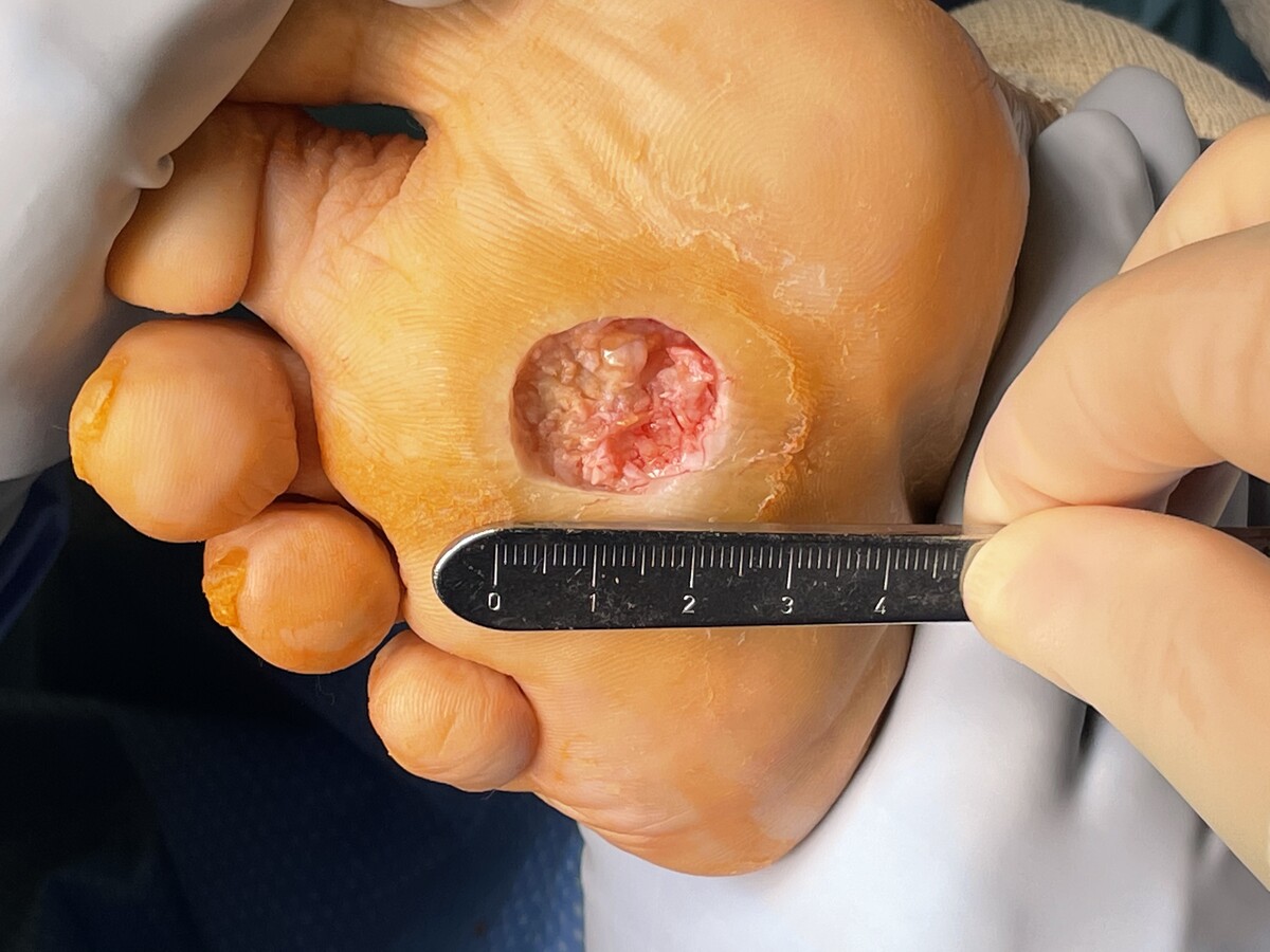Images Lakeland Foot and Ankle - Dr. William S Wong, DPM, FACFAS