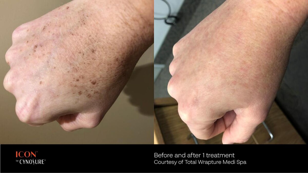 Images Circadian Rejuvenation