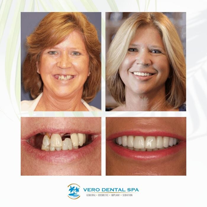 Images Vero Dental Spa