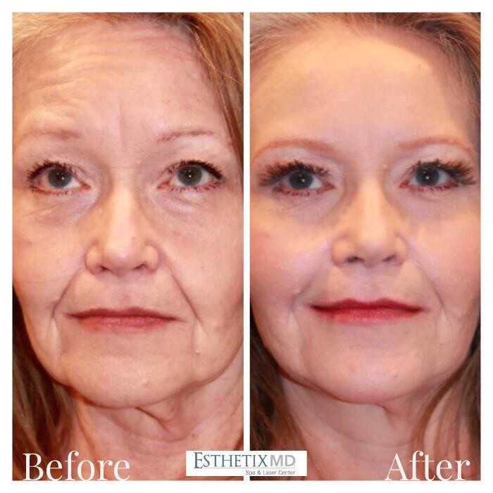 Images EsthetixMD Spa & Laser Center