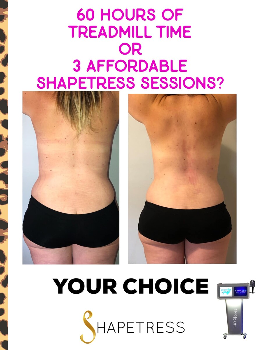 Images Shapetress
