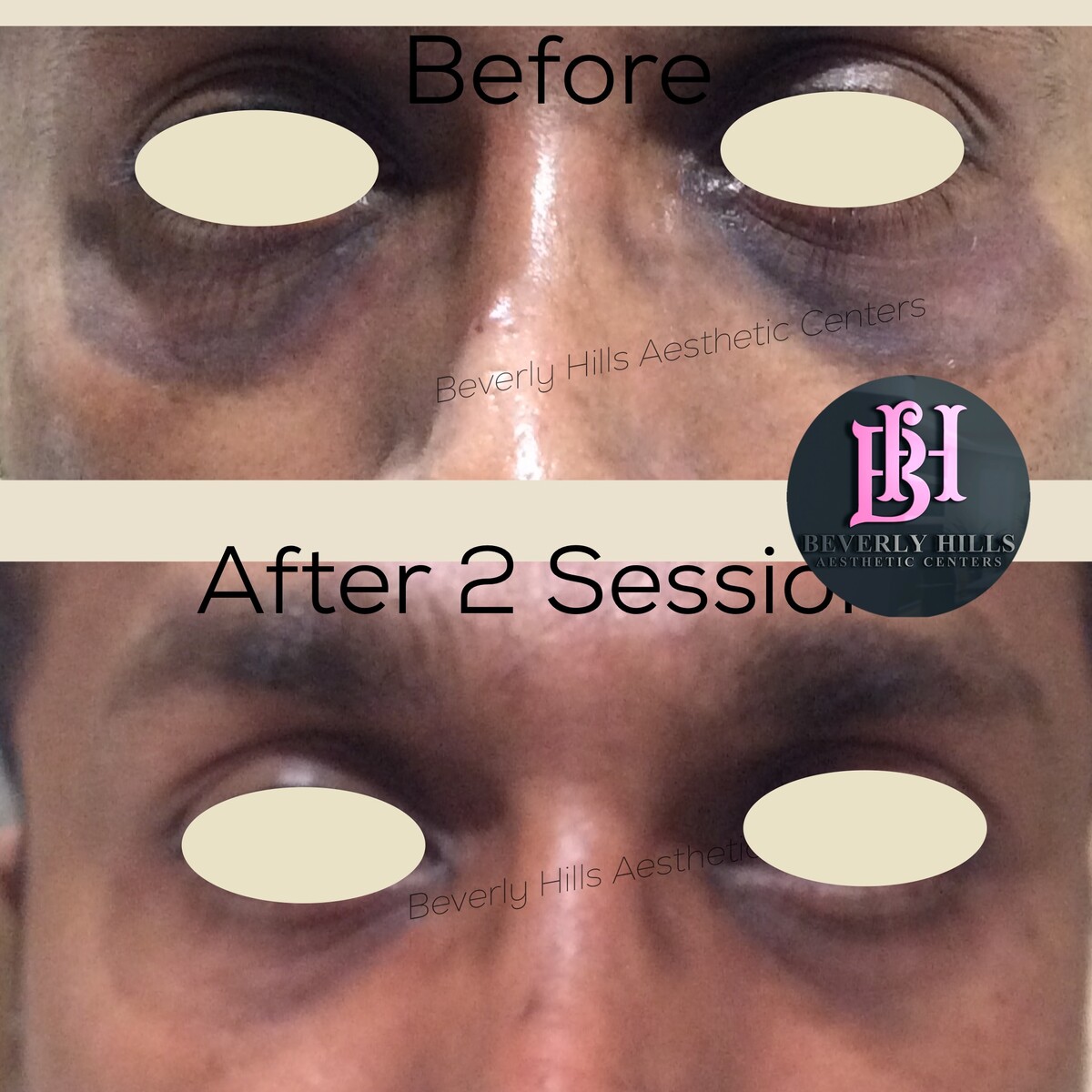 Images Beverly Hills Aesthetic Centers