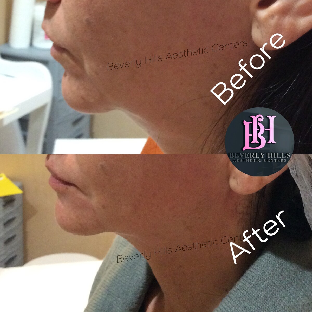 Images Beverly Hills Aesthetic Centers