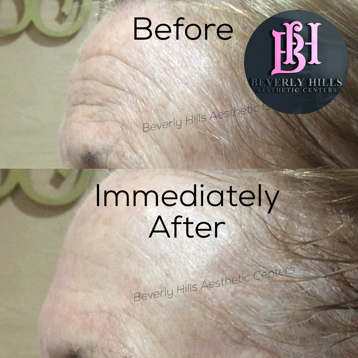 Images Beverly Hills Aesthetic Centers