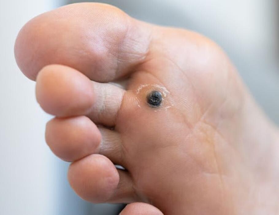 Images Annapolis Foot & Ankle Center