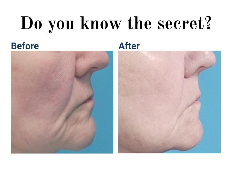 Images Global Facial Aesthetics & Rejuvenation