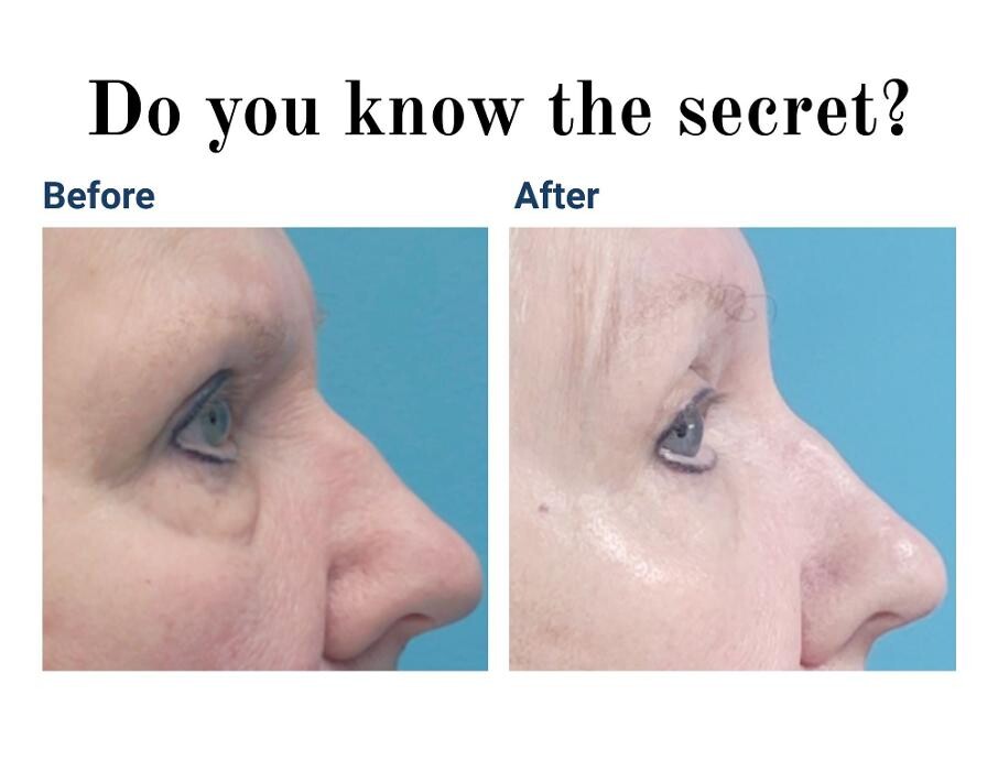 Images Global Facial Aesthetics & Rejuvenation