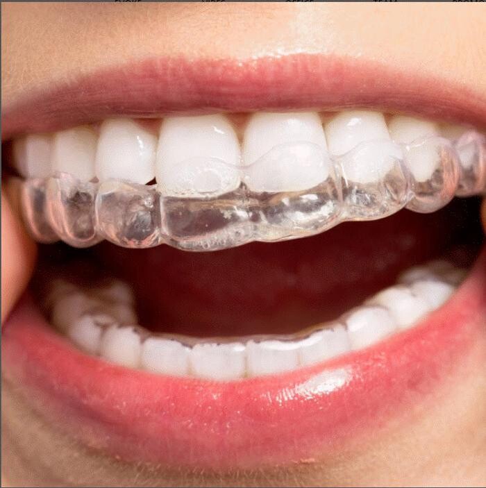 Images Image Aesthetic Dentistry