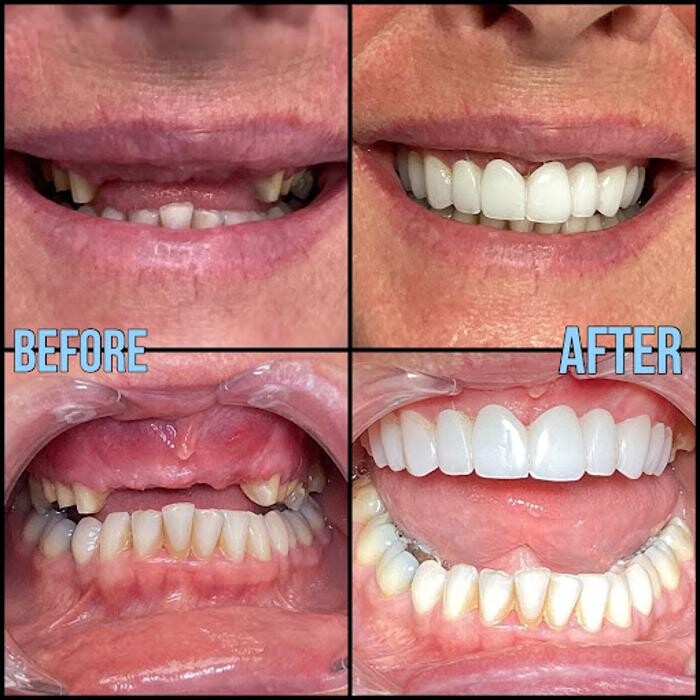 Images Bellagio Dental Implant Center