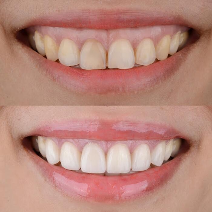 Images Bellagio Dental Implant Center